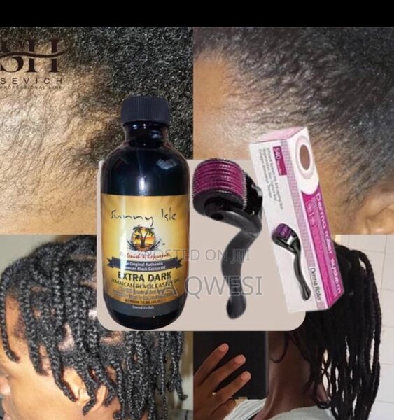 Castor Oil & Derma Roller For Hair Growth
