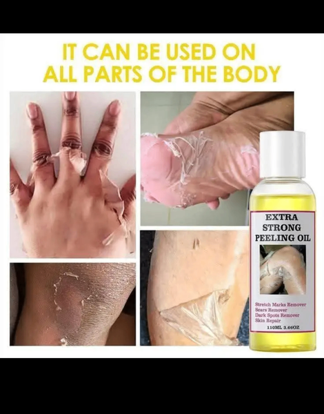 Extra strong peeling oil K250