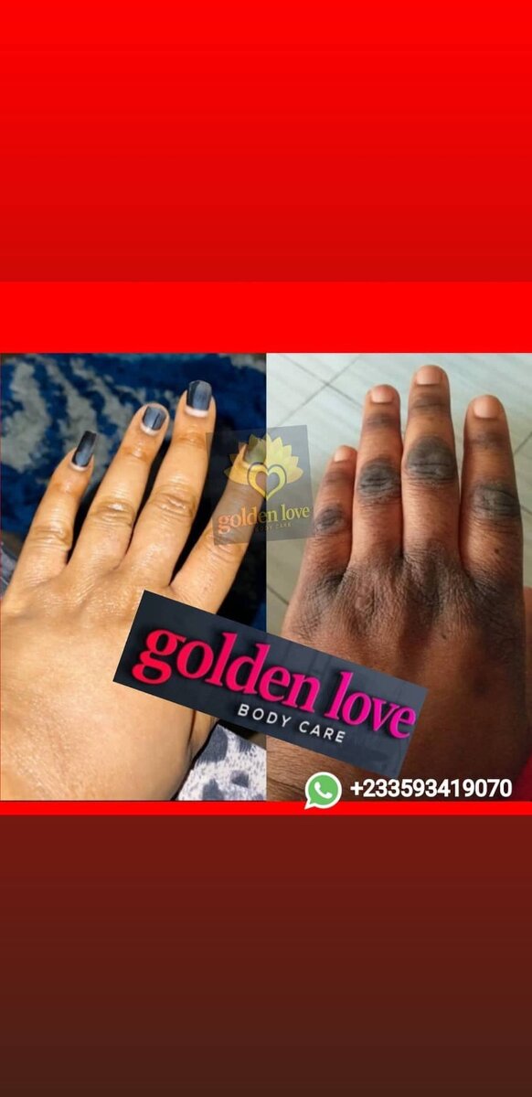 Stubborn knuckle set