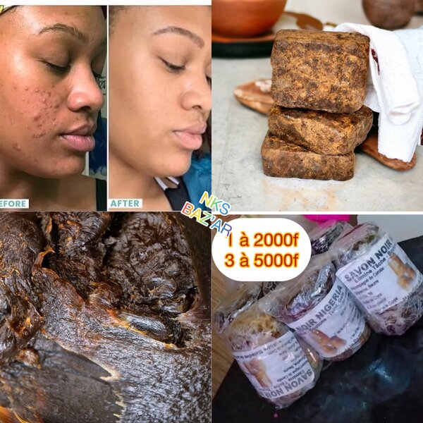 Pure savon noir. L´idéal pour traiter les boutons, taches..