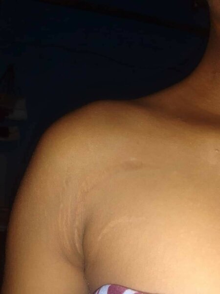 Huile Vergetures et savons