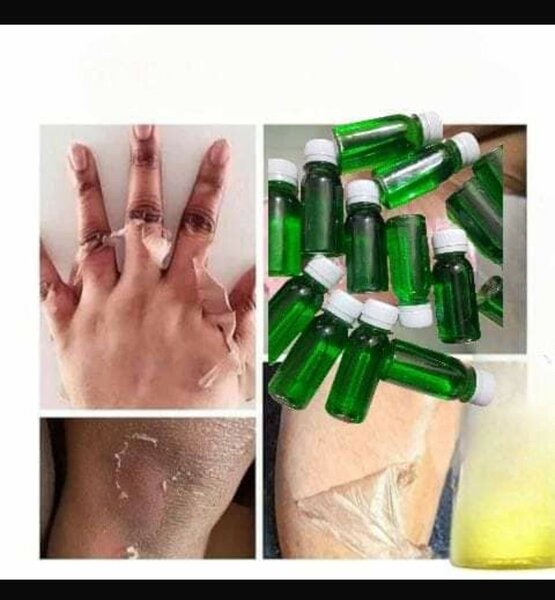 Lotion peeling quinto taches noires