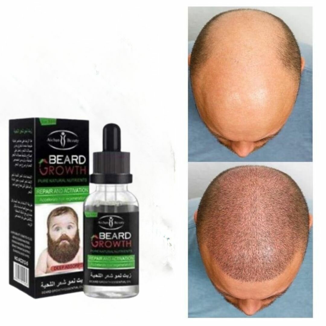 Huile pour Croissance de Cheveux