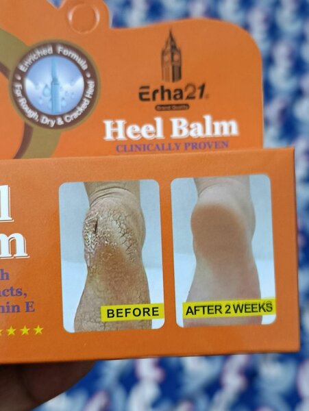 Baume réparateur des talons