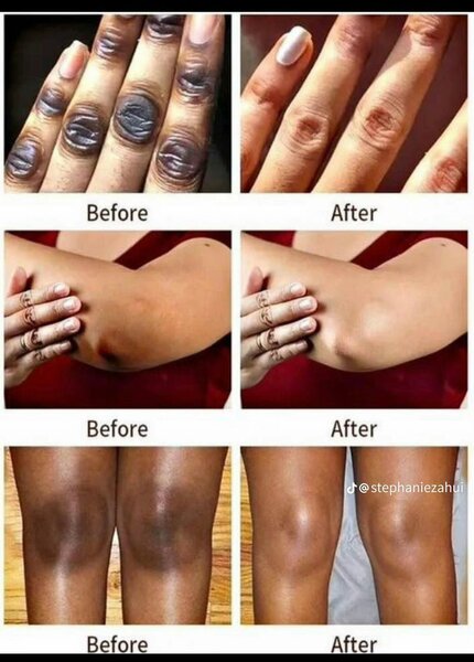 Lotion peeling quinto tâches