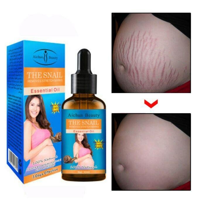 Snail Oil  - Reduces stretch marks, nourishes skin