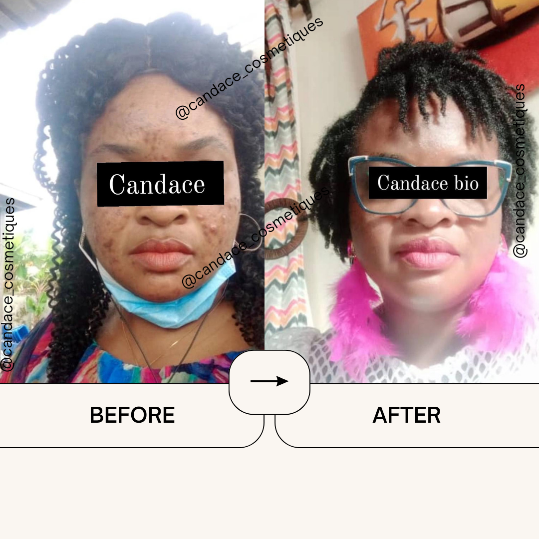 Pommade Candace Skincare bio