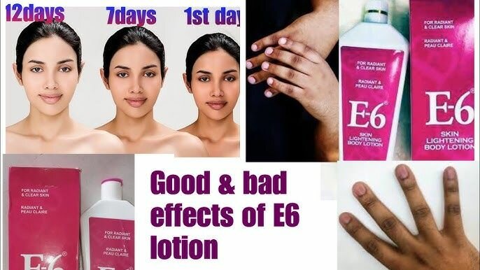 E6 Skin Lightening Lotion