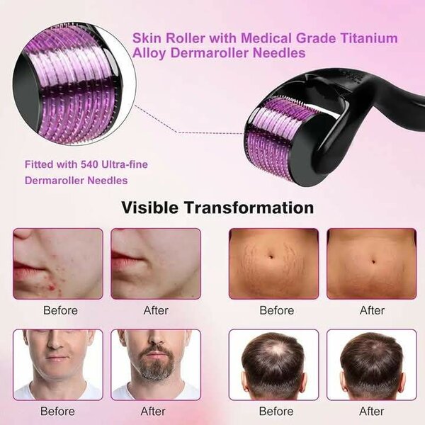 Derma Roller 540 Aiguilles