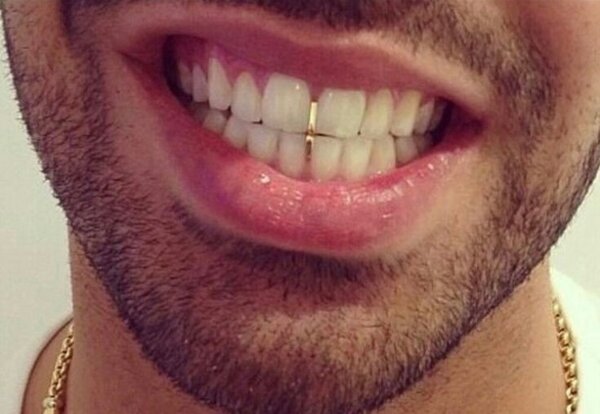 Teeth jewelry