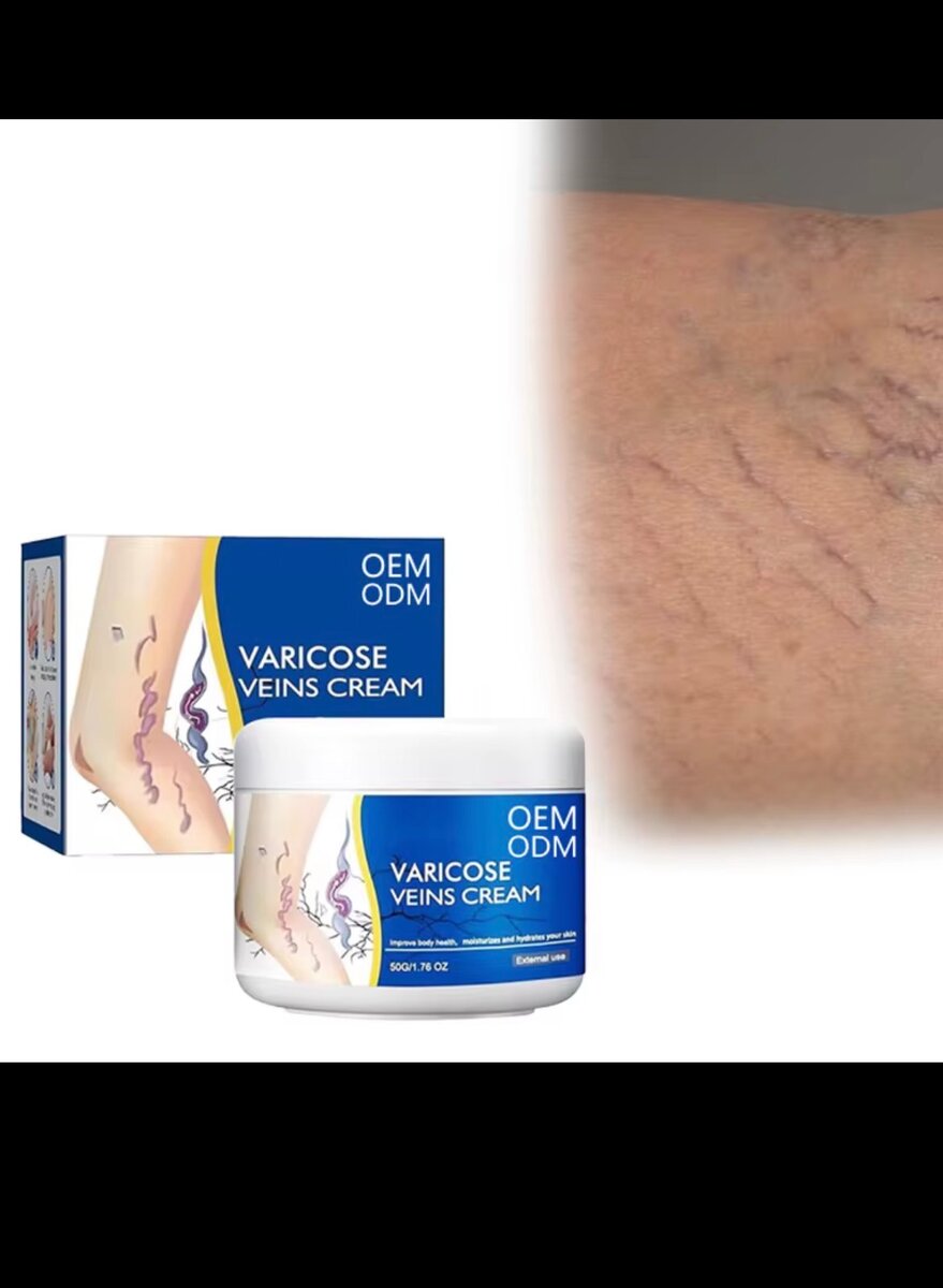 Crème Varices Soulagement