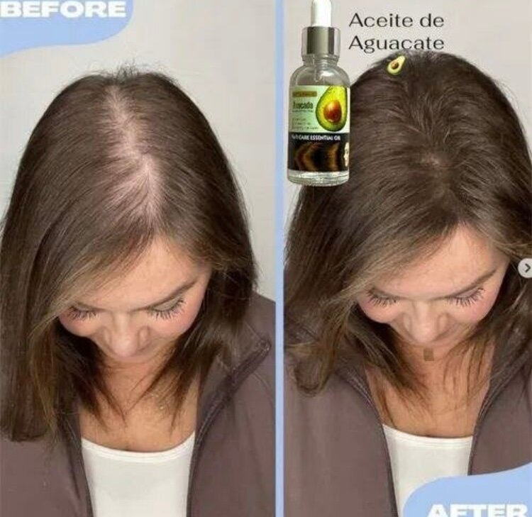 Huile d'Avocat pour Cheveux