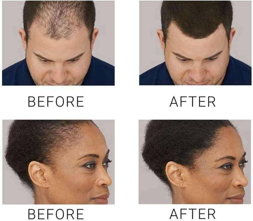 Fibres capillaires Toppik