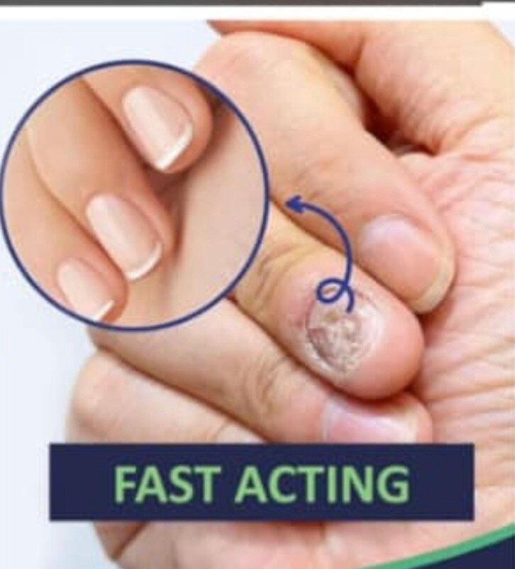 Fast acting on all nails care