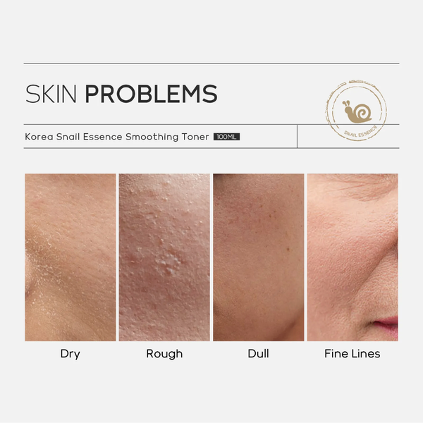 Lotion tonique soins visage