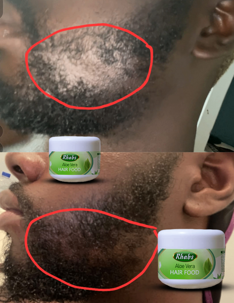 Rhabs Aloe Vera Beard & Hair Growth Food