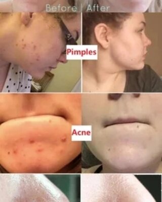 TWG beauté naturelle de la peau