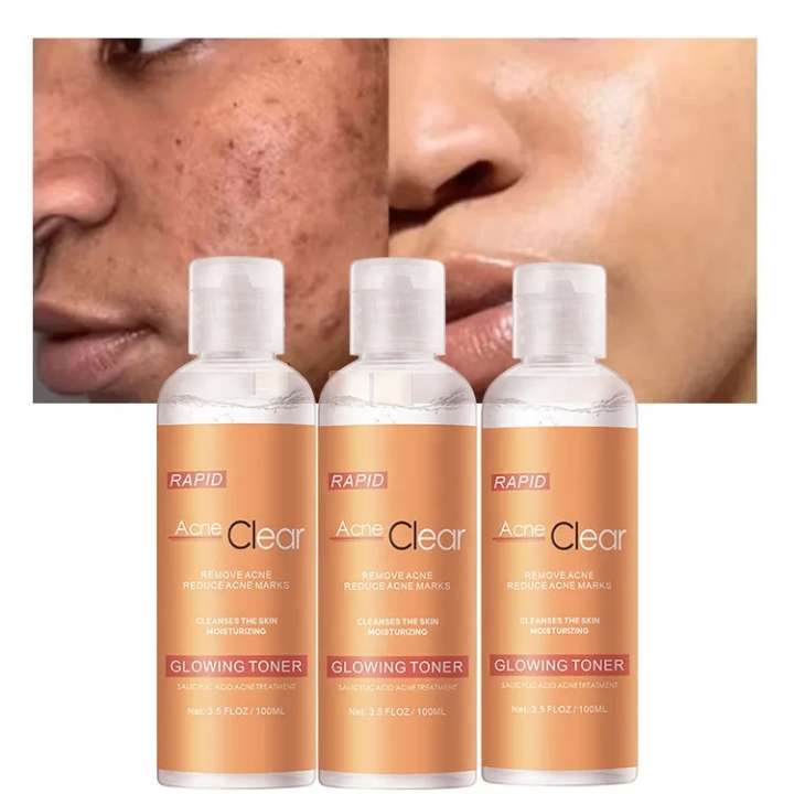 Toner Anti-Acné Rapid