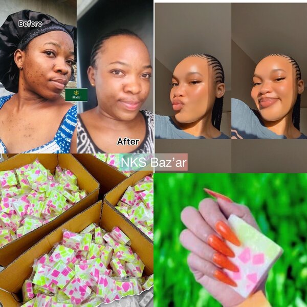 Le secret pour éliminer miraculeusement les taches