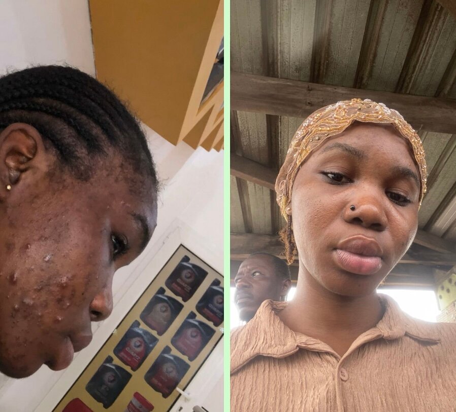 Savon Noir Naturel pour Peau