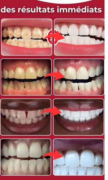 Dentifrice Blanchissant Ultra+