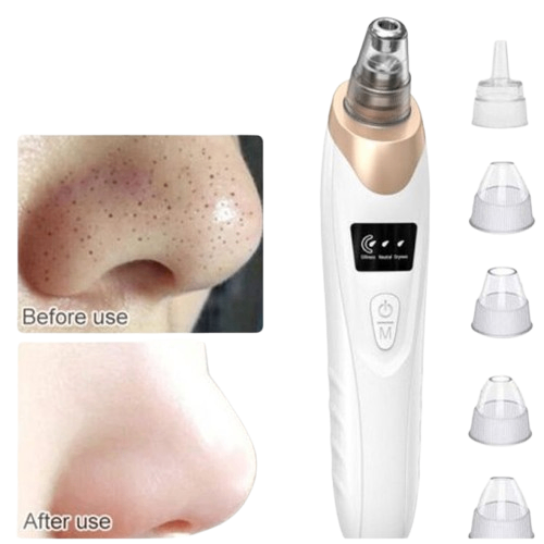 Extracteur de points de noir