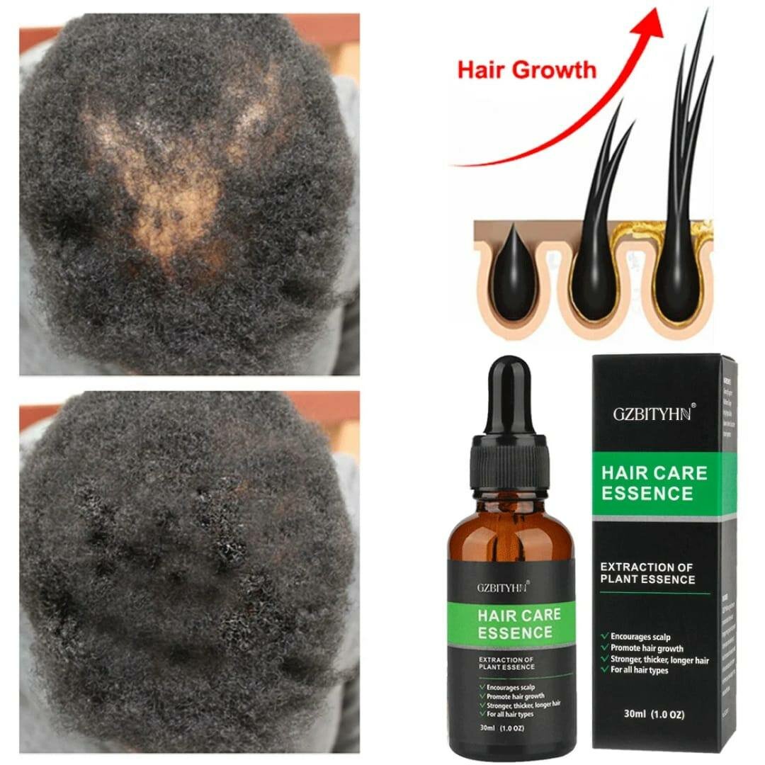 Essence soin cheveux GZBTYHN 30ml