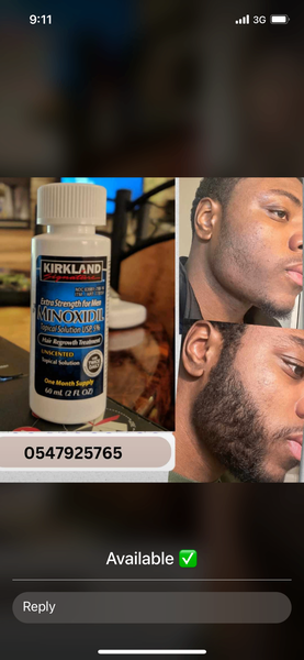 Kirkland Minoxidil Hair Growing Product