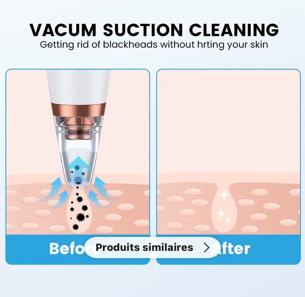 Aspirateur Points Noirs LED