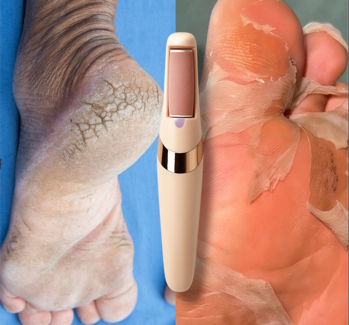 Broyeur de pieds électrique