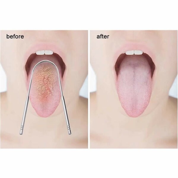 Gratte-langue en acier inoxydable