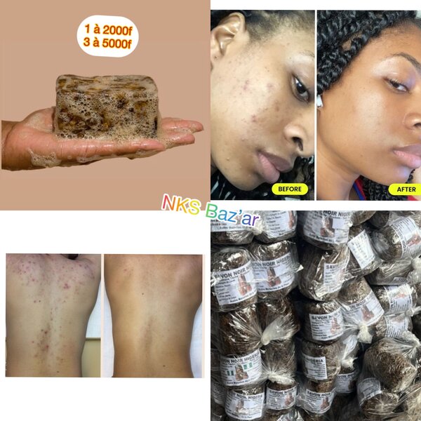 Finit les gales et boutons, nettoie les taches et embellit