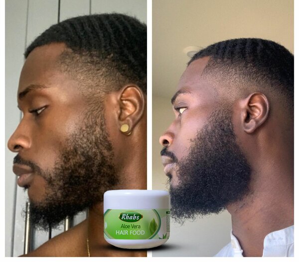 Rhabs Aloe Vera Beard & Hair Growth Food