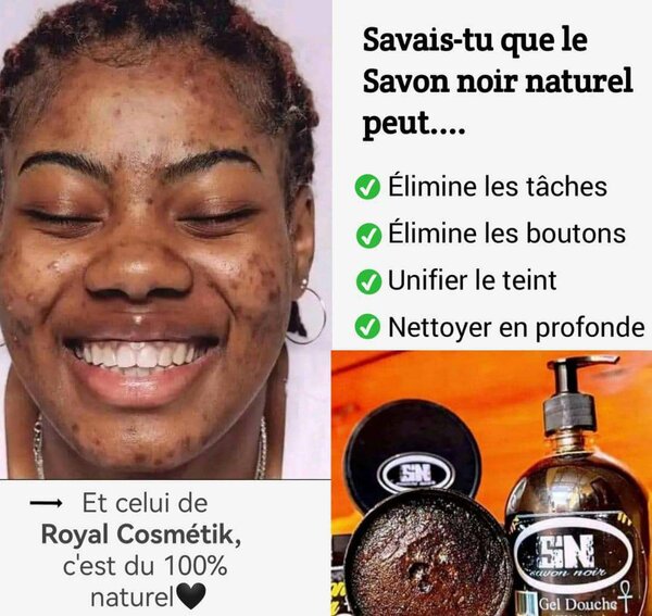 Savon Noir Naturel Peau