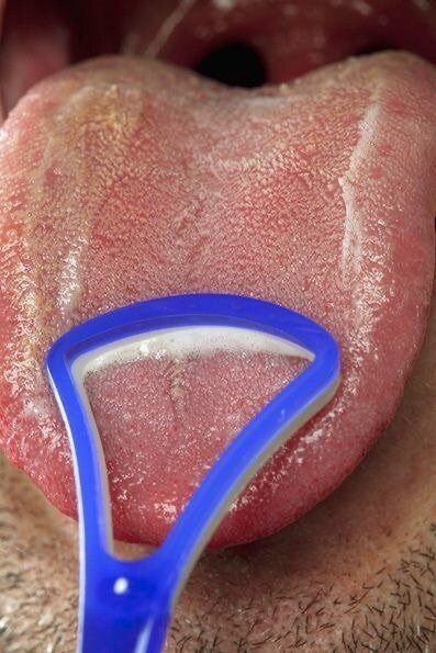 Tongue scraper