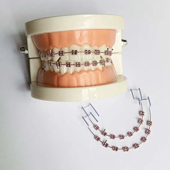 Clip-on Fashion braces (doesn't correct, just for style)