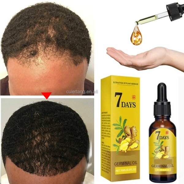 Huile Germinale pour Cheveux