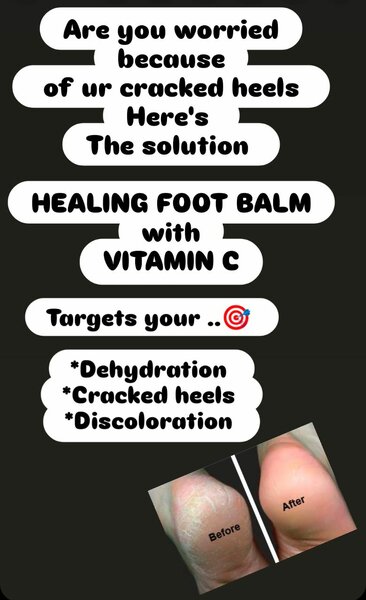 HEALING FOOT BALM with vitamin c