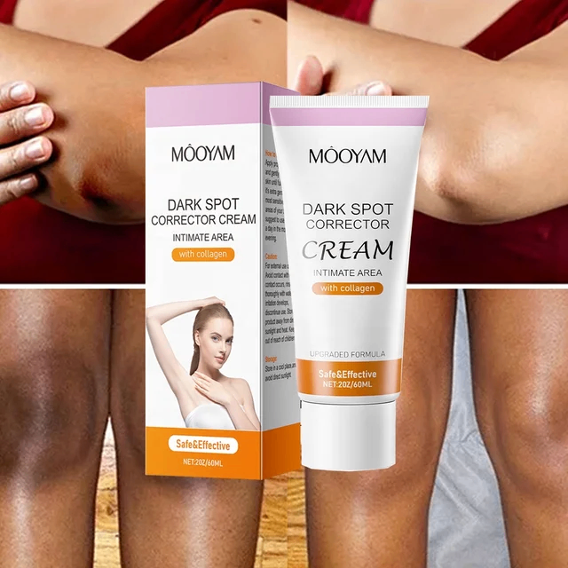 Mooyam Dark spot Corrector Cream