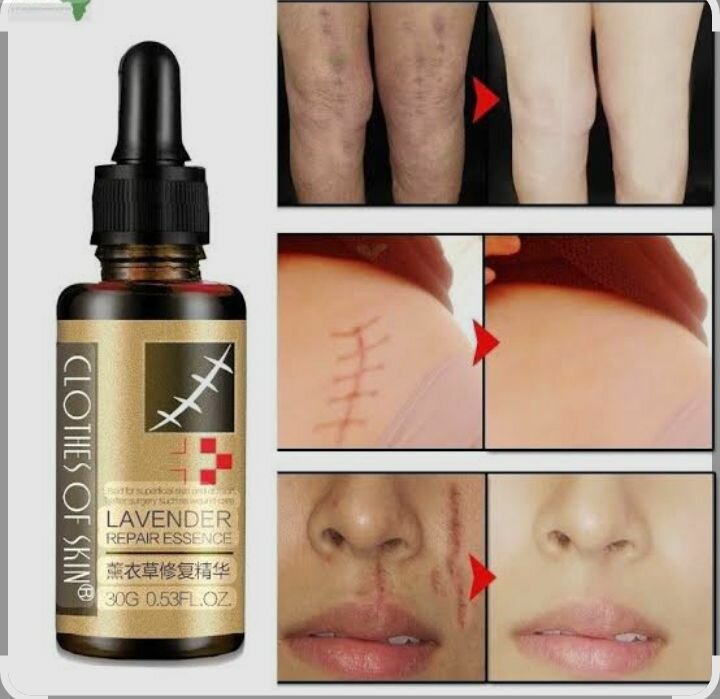 Essence réparatrice lavande cicatrices