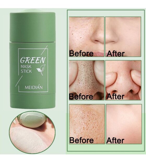 Facialmask black spot and acne