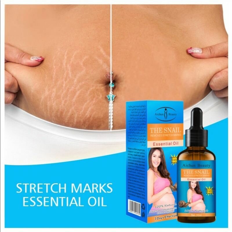 Stretch Marks removal Oil