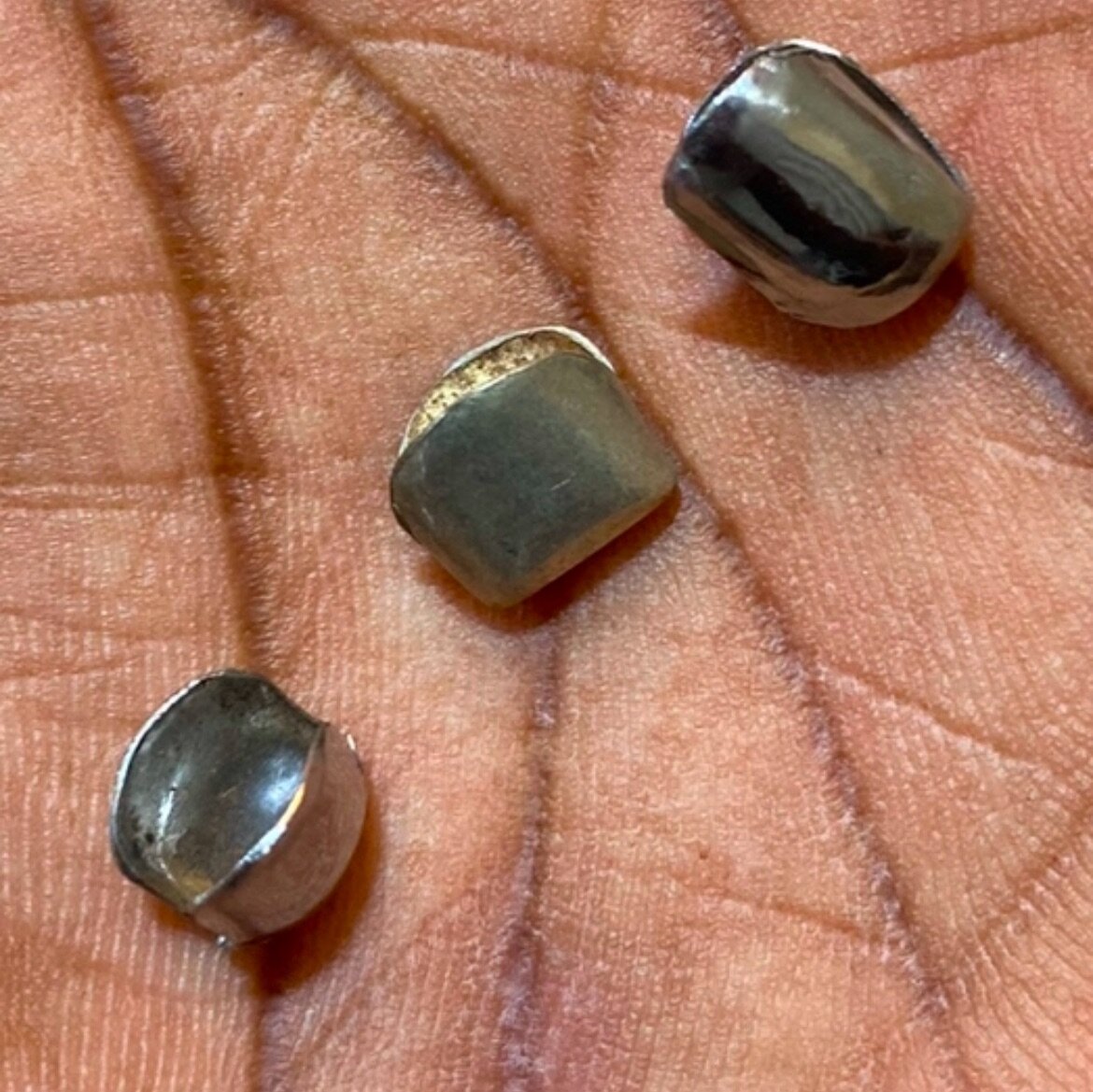 Grillz Dentaire Hip-Hop