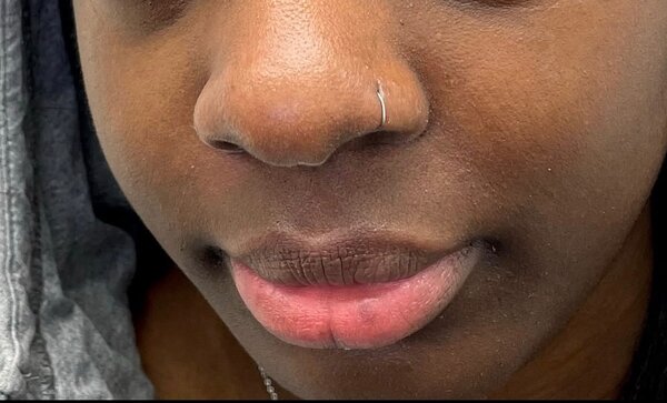 Levre rose baume rapide