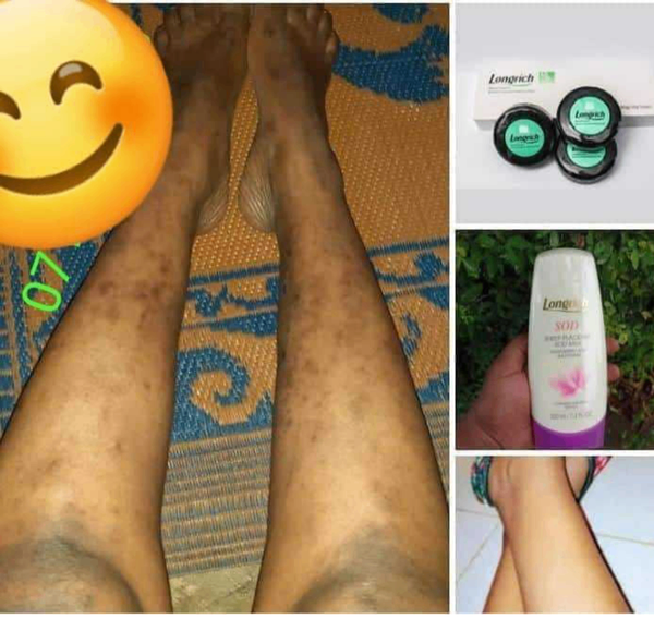 Repair your damaged skin cells with longrich products