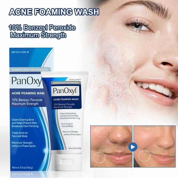 Panoxyl acne foam wash