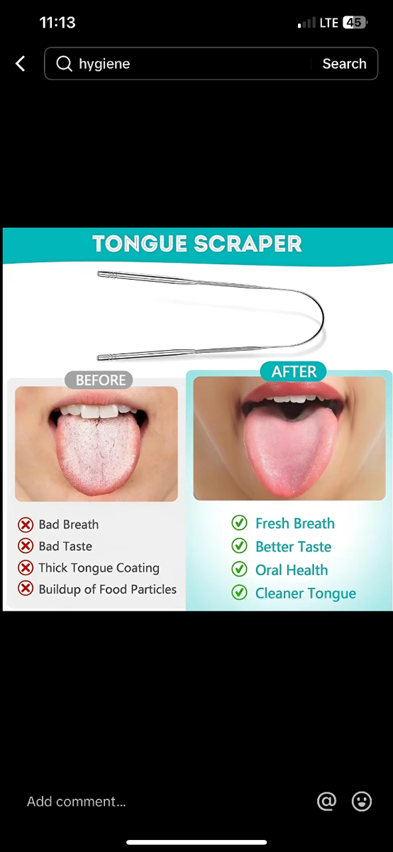 3 in 1 tongue scrapper / metallic tongue scraper
