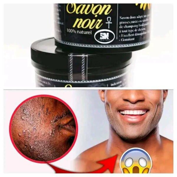 Savon Noir Peau Claires