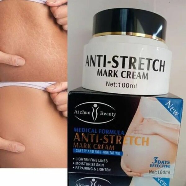 Anti stretch marks cream
