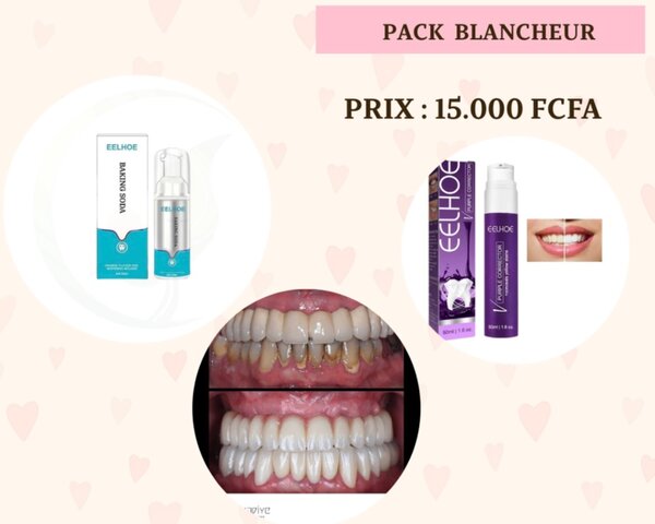 Pack  blanchiment dentaire